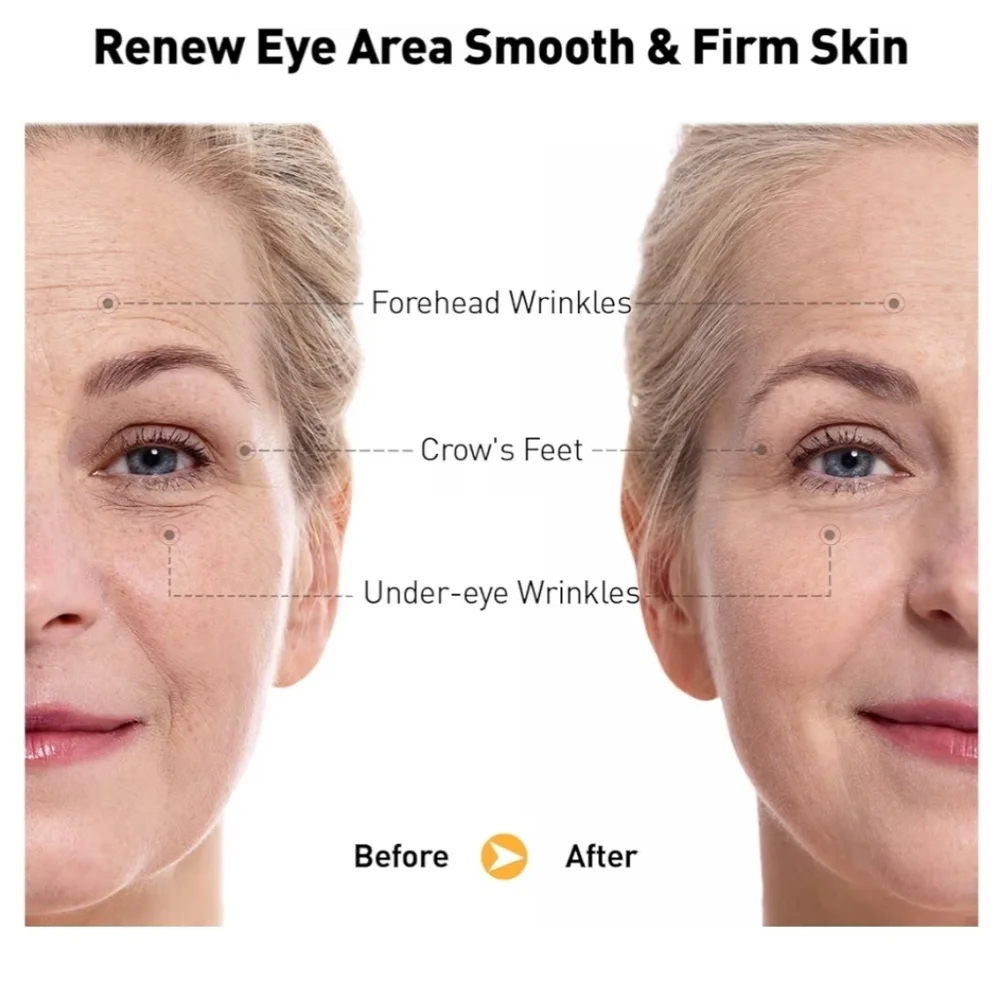 Retinol Eye Cream